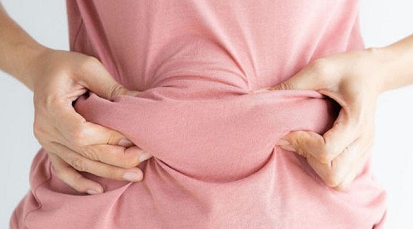 Azərbaycanda arıqlamaq üçün əməliyyata EHTİYAC OLMAYACAQ