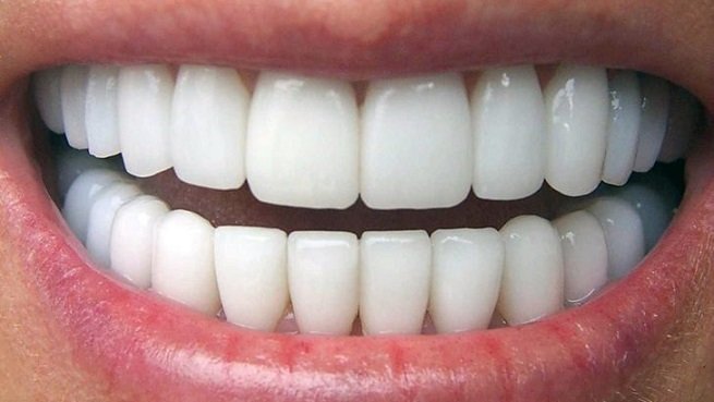 Stomatologiyada irəliləyiş: Dişlərini itirmiş insanlar üçün yeni ümid