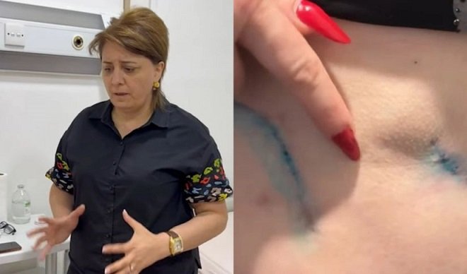 Prokurorluqda pasiyentin ölüm işində adı keçən həkim yenidən cərrahlıq edir? - VİDEO