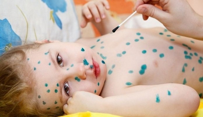 Fəsil dəyişir, bu xəstəliklər qapıda! - Pediatrdan XƏBƏRDARLIQ