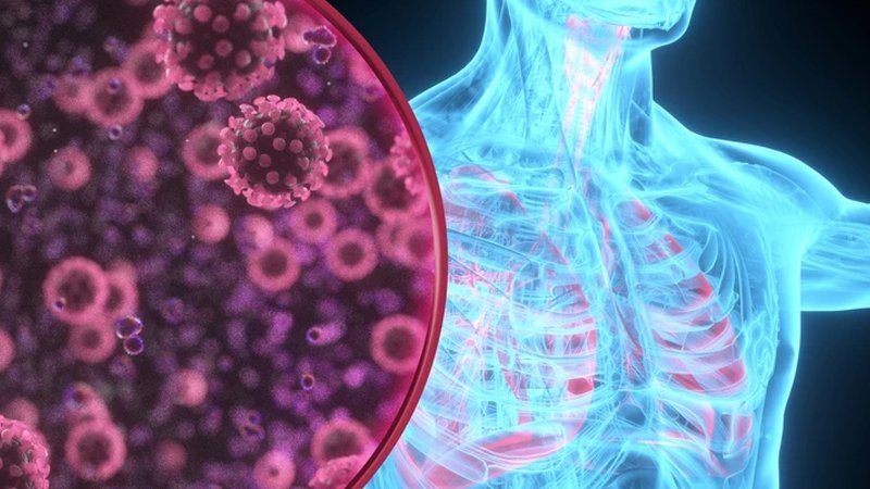 Hər il 2,5 milyon insan yoluxur - Riski artıran 6 amil