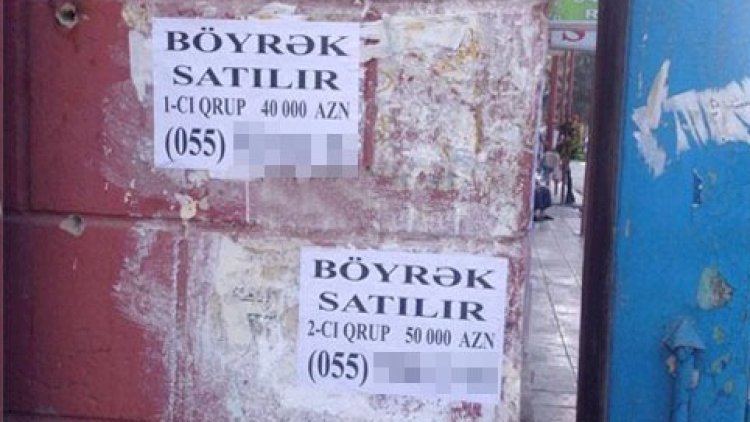 Azərbaycanda şok hadisə: Böyrəyini satmaq istəyən şəxs 6 min manat cərimələndi