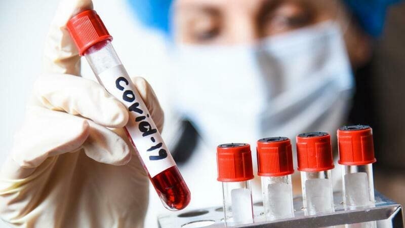 COVİD-19-la bağlı yeni araşdırma: Pandemiyaların mənşəyi ilə bağlı şok fakt