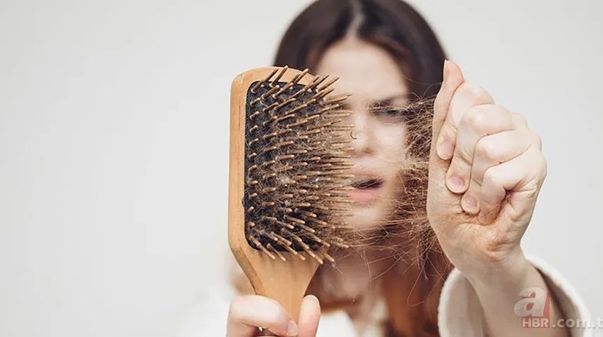 30 dəqiqəyə keçəlləşməyə SON – QIZIL ÜSUL – Hər kəsin evində var