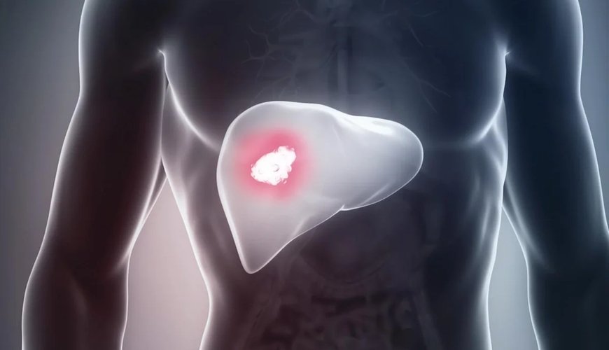 Qaraciyər xərçəngi və sirrozdan qorunmağın ən ucuz yolu: Hər gün bu içkini için