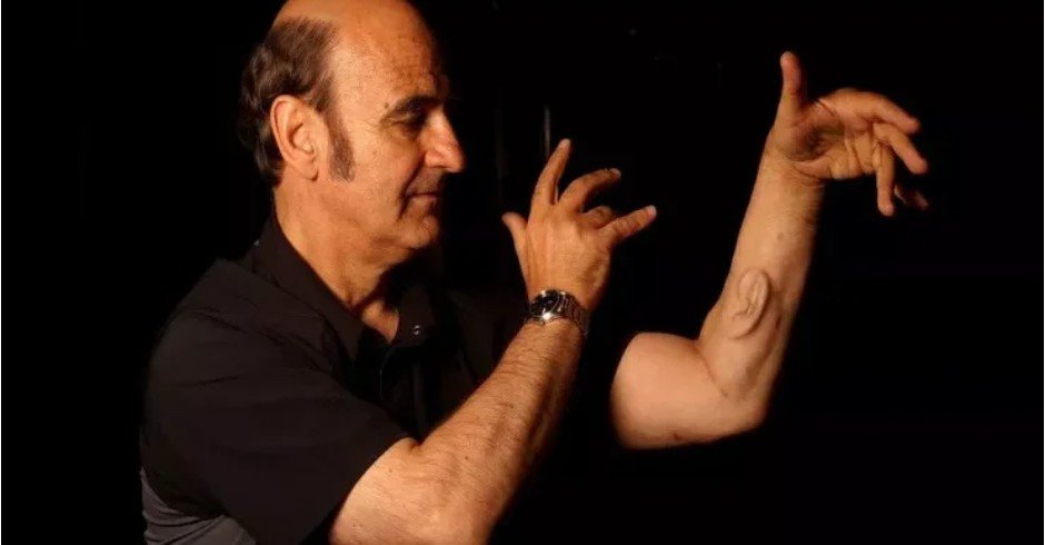 Rəssam əlinə qulaq implantasiya etdi: O, eşidə bilir