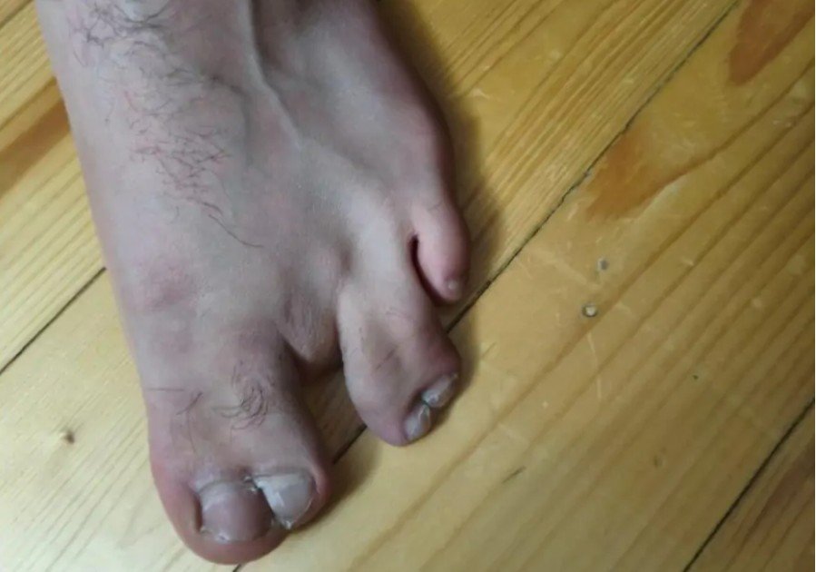 Hərbi-həkim ekspertizası niyə yararsızı “yararlı” yazır?