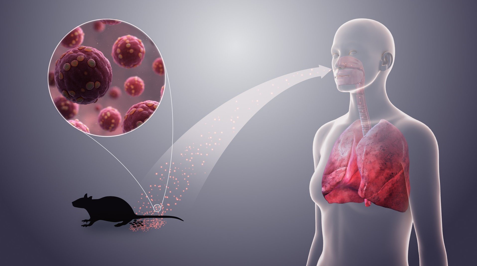 Dünyada yeni virus yayılır – ÜST xəbərdarlıq etdi
