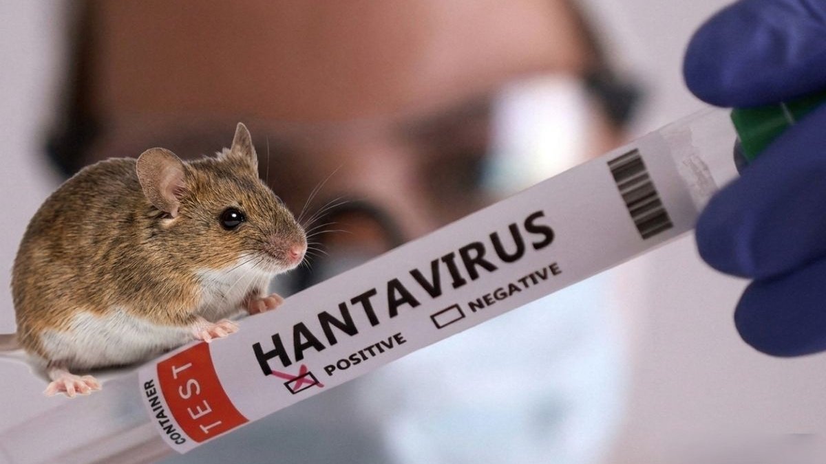 Hantavirusa görə 41 nəfər müşahidə altındadır