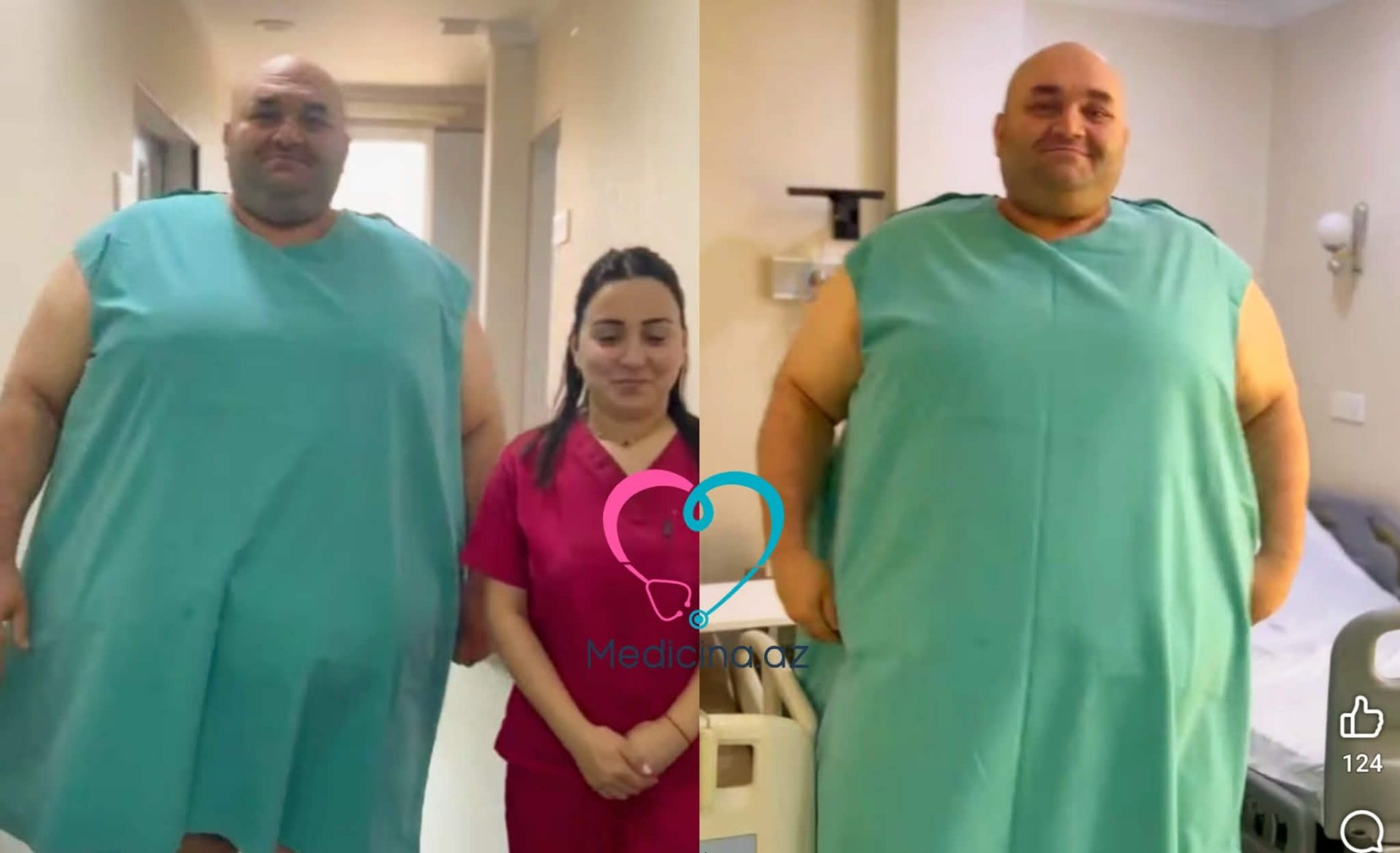 Azərbaycanda 330 kq çəkili kişi əməliyyat olundu – VİDEO