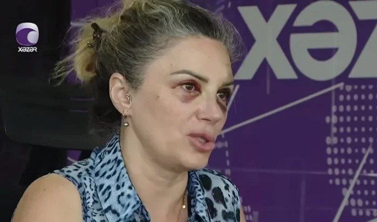 Bakıda mağazada döyülən qadın danışdı - VİDEO