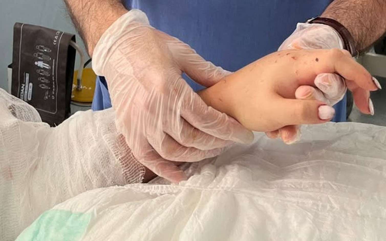 Bakıda 29 yaşlı qadının qopmuş qolu bərpa olundu - FOTO
